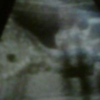 carsonsmom1's avatar